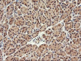 FBXO21 Antibody (clone OTI2C7)