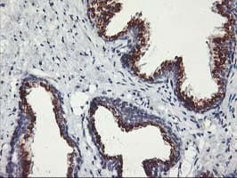 KCNJ3 / GIRK1 Antibody (clone OTI1G3)