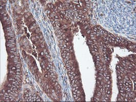 SULT1A1 / Sulfotransferase 1A1 Antibody (clone OTI5A1)