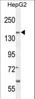 Polyclonal Rabbit anti-Human SOGA1 Antibody (aa97-125, WB)