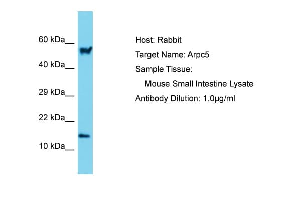 ARPC5 / p16-Arc Antibody (N-Terminus)