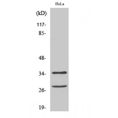 CASP6 / Caspase 6 Antibody (120-200 aa, Internal)