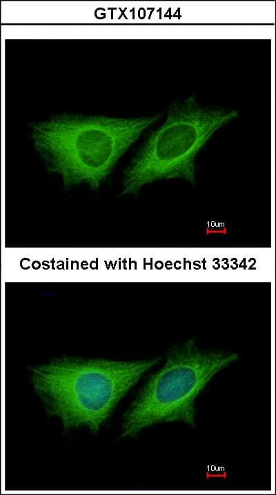 IHC-plus™ CCDC170 / C6orf97 Antibody (aa442-715)