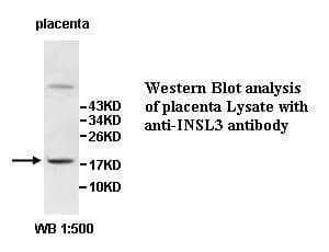 INSL3 Antibody (aa29-128)