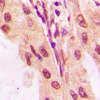Polyclonal Rabbit anti-Human TP53 / p53 Antibody (C-Terminus, IHC, WB)