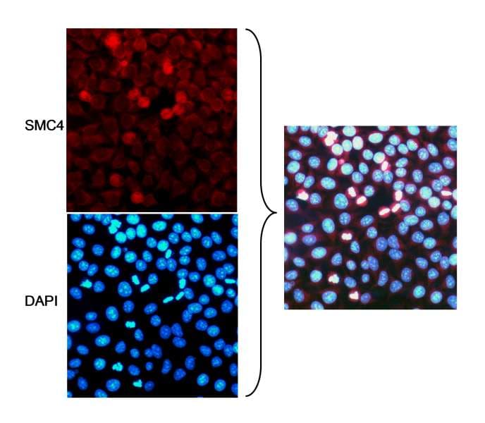 Polyclonal Rabbit anti-Human SMC4 Antibody (aa600-650, IF, WB)