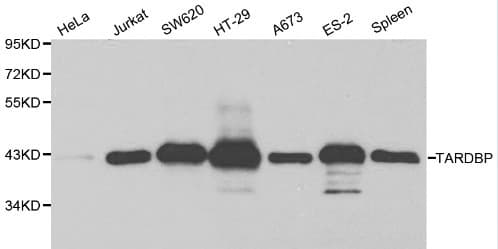 TDP-43 / TARDBP Antibody