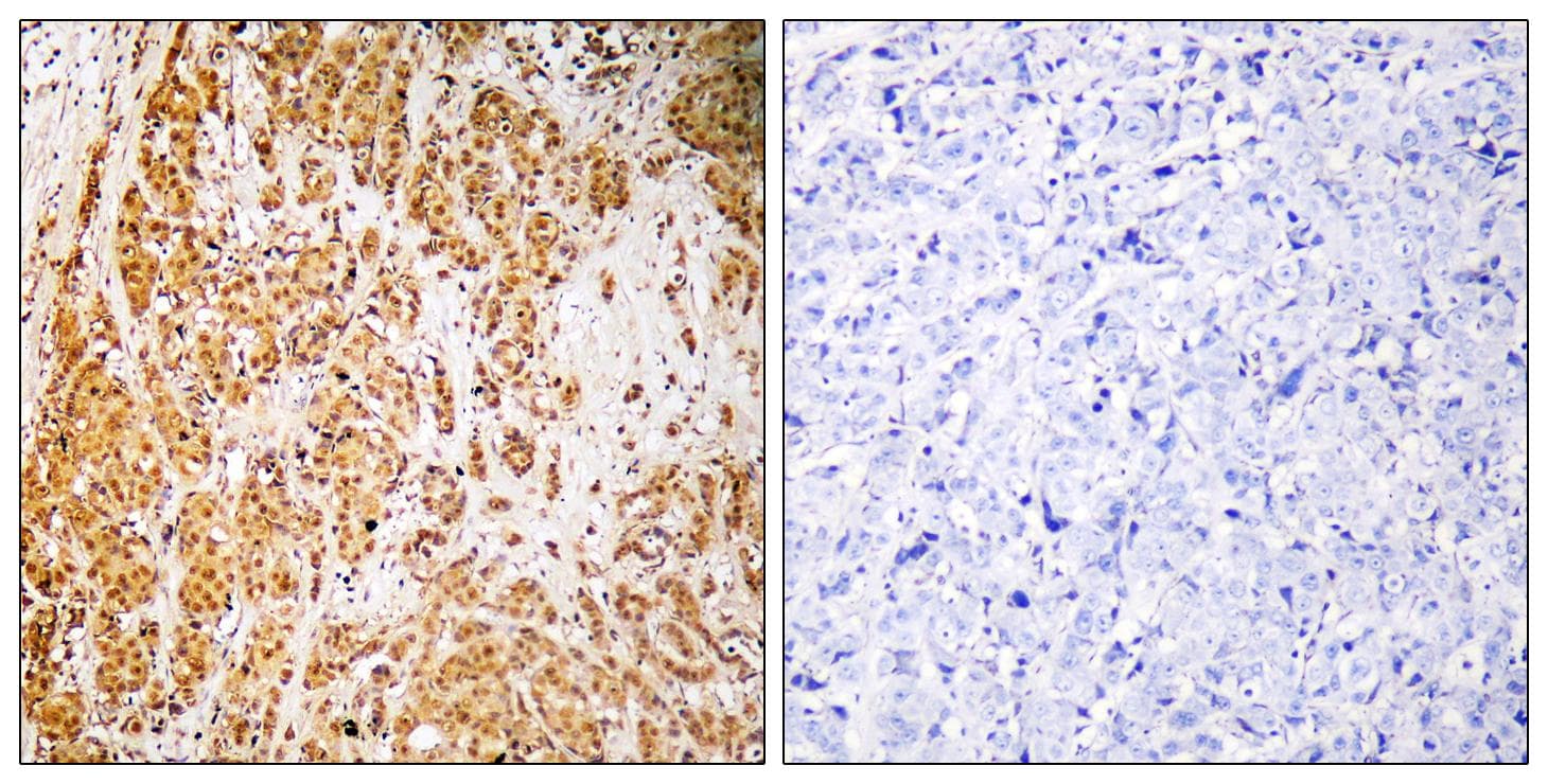 Polyclonal Rabbit anti-Human ZSCAN22 Antibody (IHC, WB)