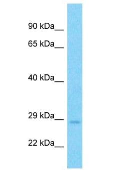 ARMC1 Antibody (aa231-280)