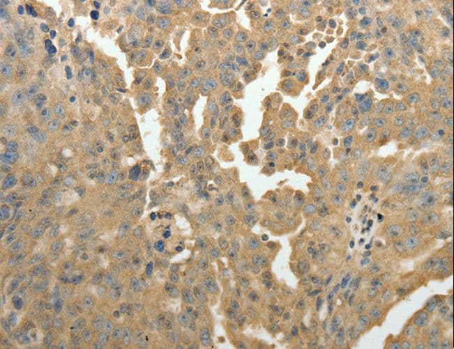 Polyclonal Rabbit anti-Human PSMD9 / 26S Proteasome Antibody (IHC, WB)