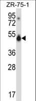 CELF1 / CUGBP1 Antibody (aa1-30)