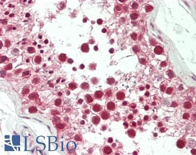 IHC-plus™ SMPD1 / Acid Sphingomyelinase Antibody