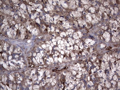 TG / Thyroglobulin Antibody (aa20-358, clone OTI1C8)
