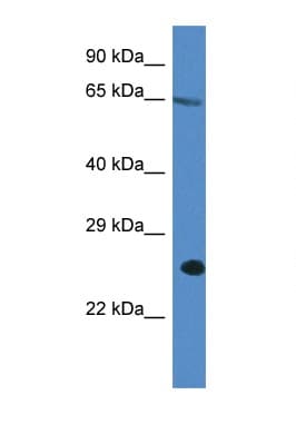 ITPRIP Antibody (C-Terminus)
