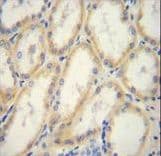 Polyclonal Rabbit anti-Human G6PC / Glucose-6-Phosphatase Antibody (aa123-149, IHC, WB)