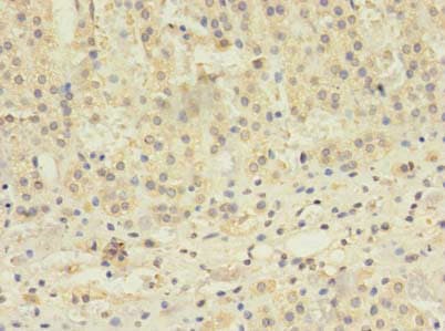 TBC1D20 Antibody