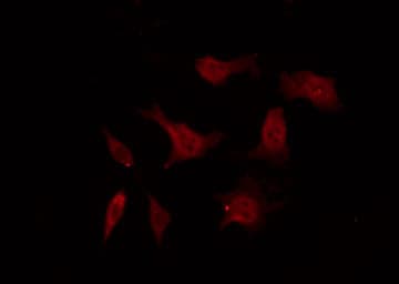 TH / Tyrosine Hydroxylase Antibody (phospho-Ser40)