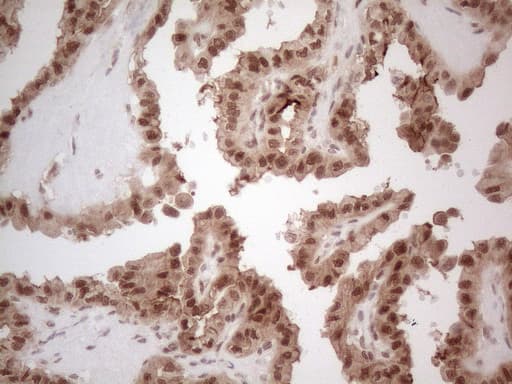 IRS1 Antibody (aa1-280, clone OTI9E11)
