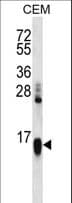 HIST1H2AA Antibody (aa1-30)