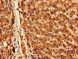 Polyclonal Rabbit anti-Human OAS1 Antibody (IHC)