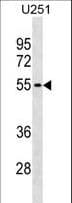Polyclonal Rabbit anti-Human KLHDC7B Antibody (aa442-471, WB)