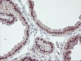 RFXANK Antibody (clone OTI2F12)