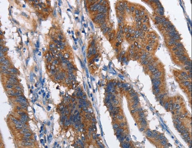 Polyclonal Rabbit anti-Human CMT2 / MAD2L1BP Antibody (IHC)