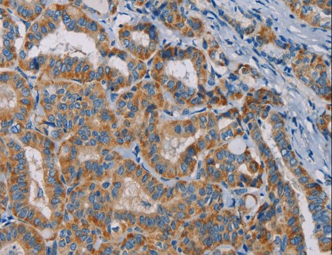 Polyclonal Rabbit anti-Human NAP1 / TAB3 Antibody (IHC, WB)