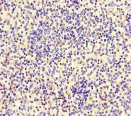 LF / LTF / Lactoferrin Antibody