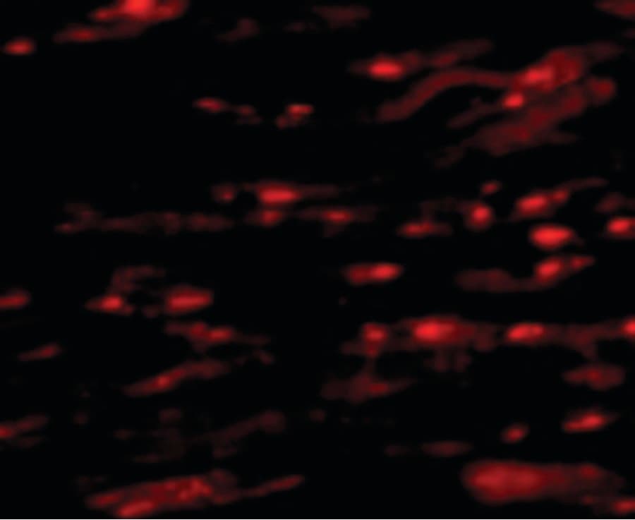 IHC-plus™ Polyclonal Rabbit anti-Human ASAH1 / Acid Ceramidase Antibody (IHC, IF, WB)