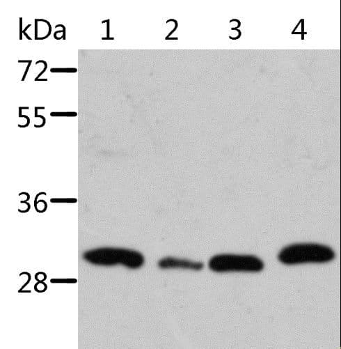Polyclonal Rabbit anti-Human STRADB / ALS2CR2 Antibody (IHC, WB)