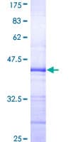 Human ELF3 / ESE1 Protein (Recombinant GST, N-terminus)