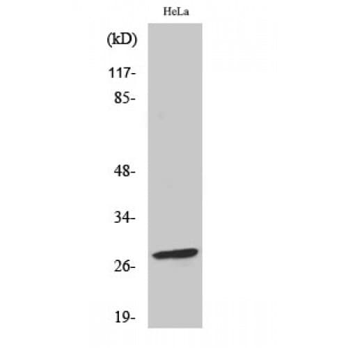 Polyclonal Rabbit anti-Human BCL2 / Bcl-2 Antibody (10-90 aa, IHC, WB)