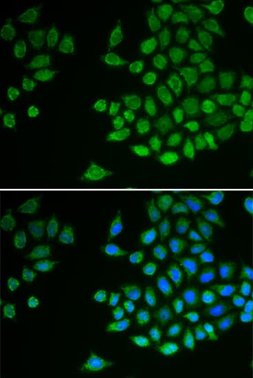 PTPN2 / TC-PTP Antibody