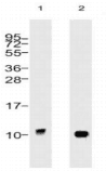 UBC / Ubiquitin C Antibody (clone 5B9.B3)
