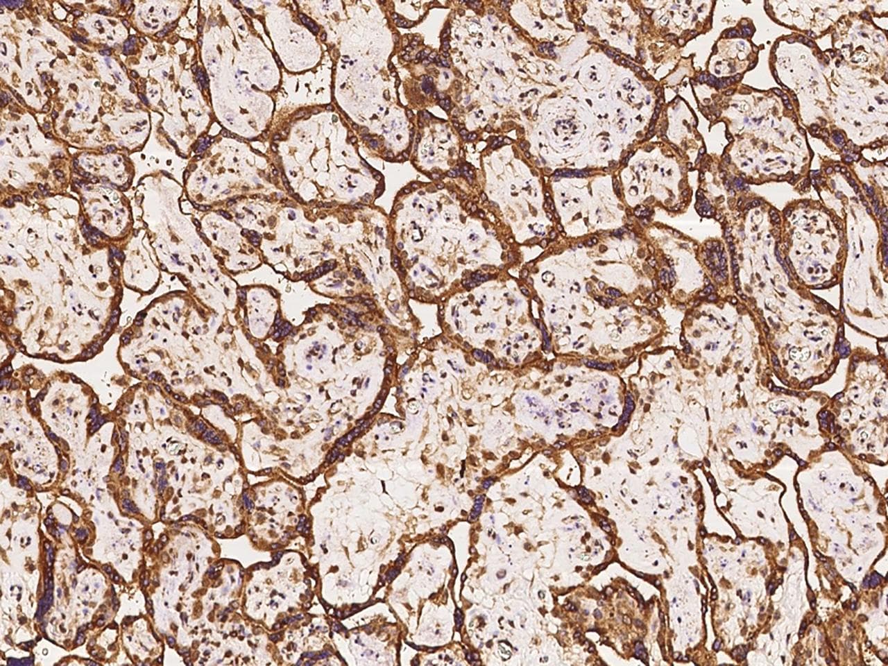 SEMA4G / Semaphorin 4G Antibody