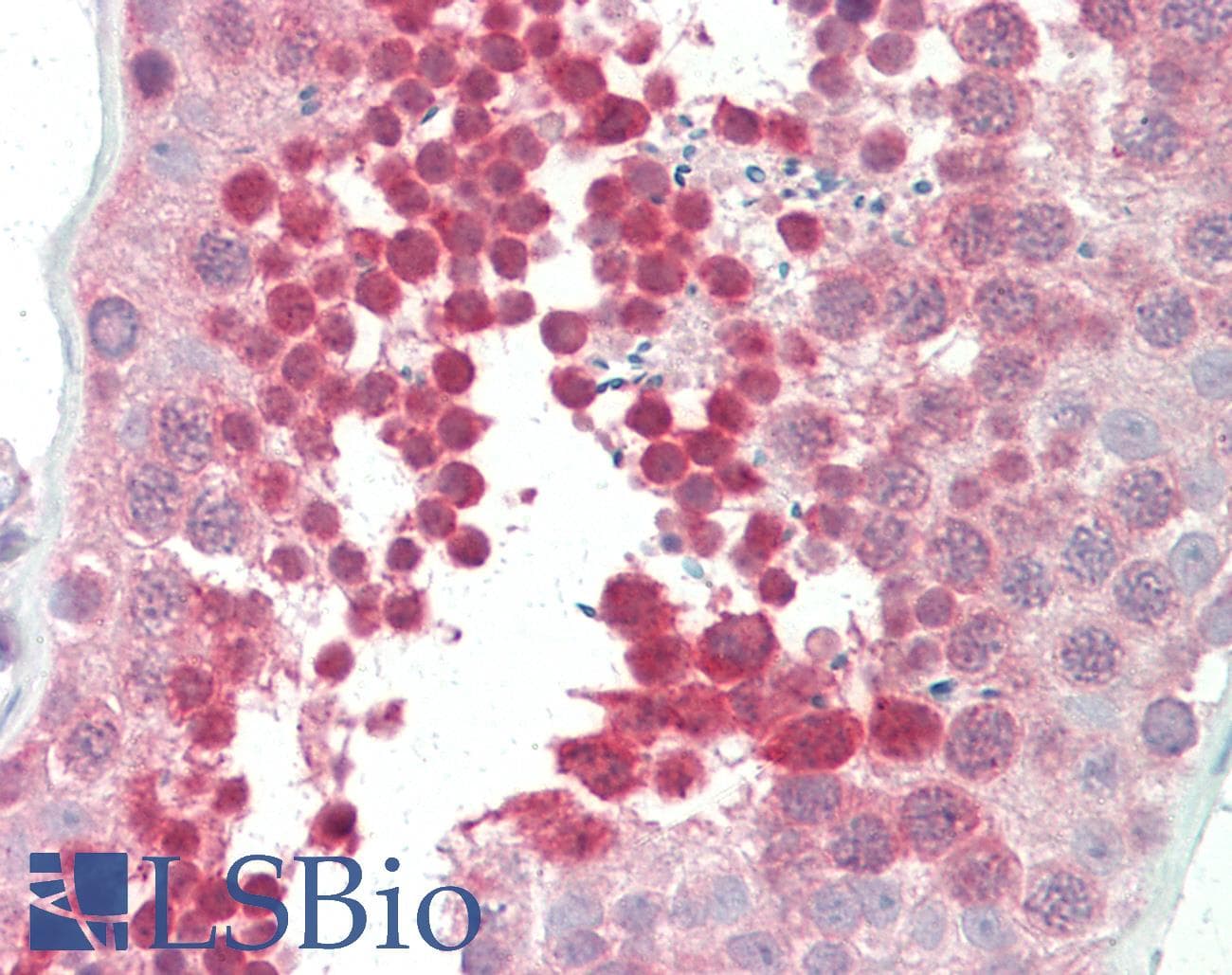 Polyclonal Rabbit anti-Human YBX3 / CSDA Antibody (aa290-339, IHC, WB)