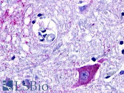 PathPlus™ GPCRW / GPR18 Antibody (Extracellular Domain)