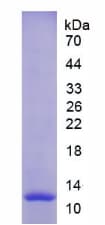 Rat MMP12 Protein (Recombinant His)