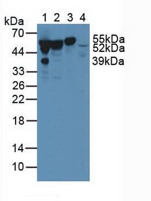 GC / Vitamin D-Binding Protein Antibody (aa209-401)