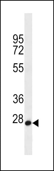 Polyclonal Rabbit anti-Human MED22 Antibody (aa1-30, WB)