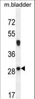 NCALD / Neurocalcin Delta Antibody (aa147-174)