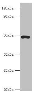 ACTR3B / ARP4 Antibody (aa189-418)