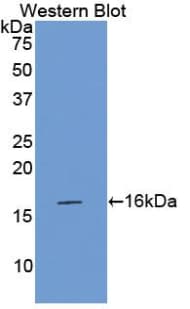 F7 / Factor VII Antibody (aa315-433)
