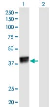 HNRNPC / HNRNP C Antibody (clone 4E8)