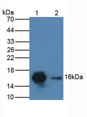 CDA / Cytidine Deaminase Antibody (aa2-146)