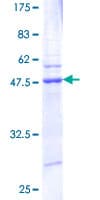 Human ARL1 Protein (Recombinant GST)