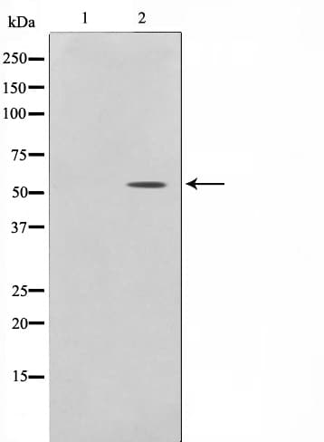 PPARA / PPAR Alpha Antibody