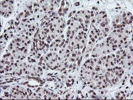 TPD52L3 Antibody (clone OTI3D11, Carrier-free)
