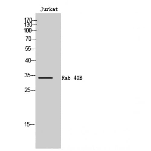RAB40B Antibody (210-290 aa, C-terminal)